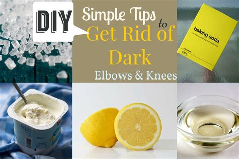 Simple Tips to Get Rid of Dark Elbows Knees - 24 Hour Home Remedies | Dark elbows, Beauty ...