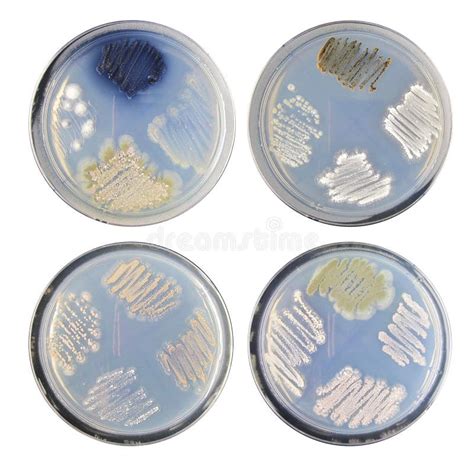 Set Of Varity Colony Bacteria (actinomycetes) Morphology On Agar Stock ...