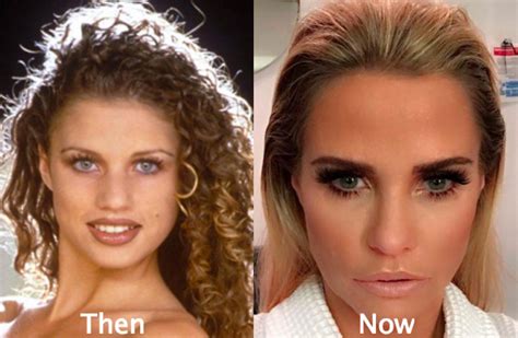 Katie Price Plastic Surgery Before and After Photos