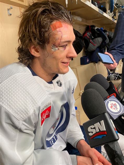 Jets’ Morgan Barron shows off gnarly scars from 75 stitches after ...