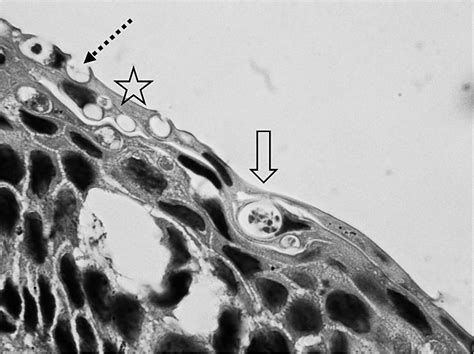 BATRACHOCHYTRIUM DENDROBATIDIS IN AQUATIC CAECILIANS (TYPHLONECTES NATANS): A SERIES OF CASES ...