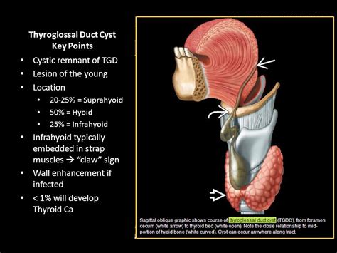 Thyroglossal Duct Cyst Anatomy