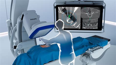 Philips introduces ClarifEye Augmented Reality Surgical Navigation to advance minimally-invasive ...