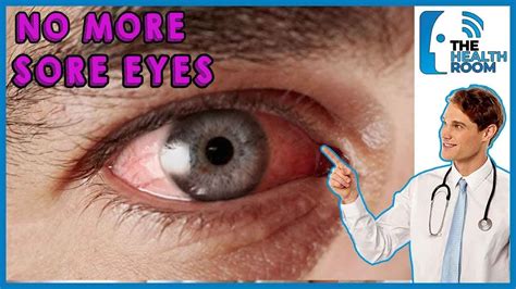 How to CURE SORE EYES NATURALLY: 10 Effective Ways (2021) - YouTube