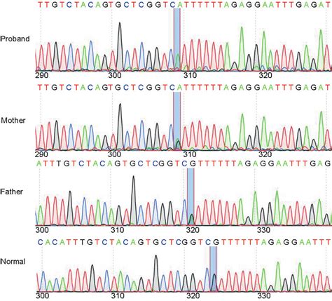 Sanger-sequencing results showing the homozygous c.6934G>A mutation in... | Download Scientific ...