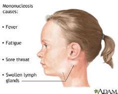 swollen lymph node in front of ear