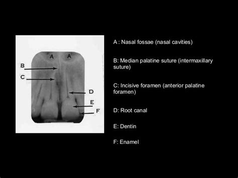 Normal radiographic anatomy