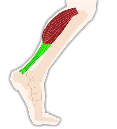 Tendinitis vs Tendinosis | Custom Rehab Physical Therapy