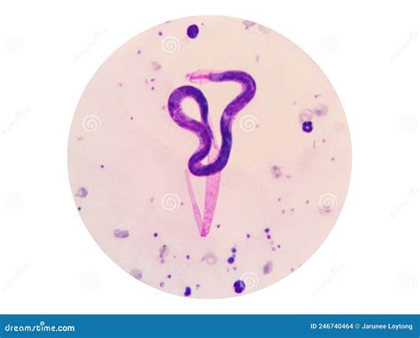 Microscopic Examination of Stained Blood Films Used To Differentiate ...