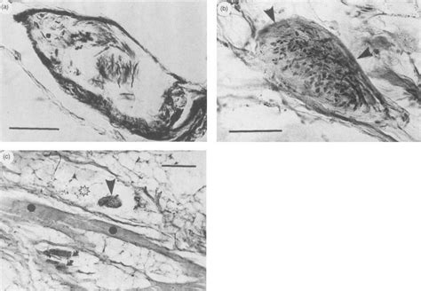 Golgi tendon organs. (A) An oval-shaped Golgi tendon organ in a normal... | Download Scientific ...