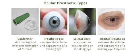 Eye Conditions and Solutions with Northwest Eye Design