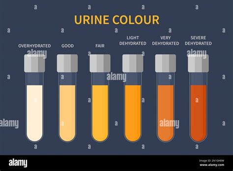 Urine color chart illustration of dehydration level Stock Vector Image & Art - Alamy
