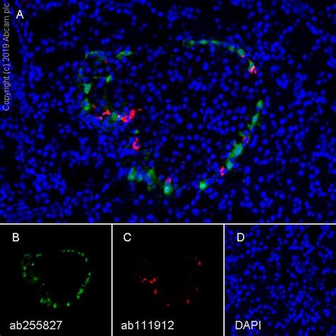 F4/80抗体[F4/80] - Macrophage Marker| Abcam中文官网