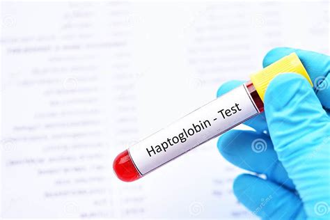 Blood Sample Tube for Haptoglobin Test Stock Photo - Image of ...