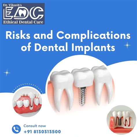 Risks and Complications of Dental Implants