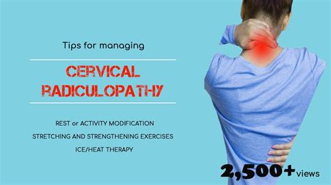 Tips for managing cervical radiculopathy(physiotherapy) - YouTube