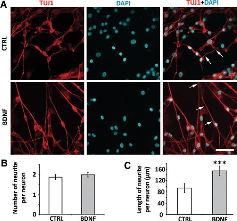 Figure 3 from Differentiation of Spiral Ganglion-Derived Neural Stem ...