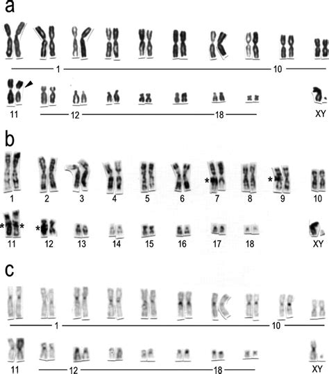 Karyotype evolution of shrew moles (Soricomorpha: Talpidae)