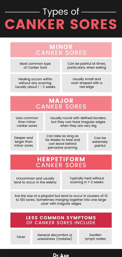 Canker Sore Symptoms And Treatments - Infoupdate.org