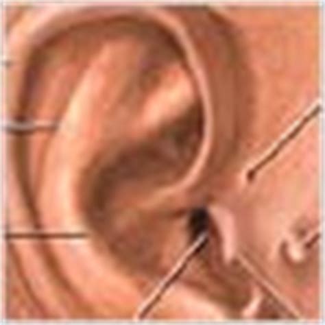 Ear Wax - Symptoms, Diagnosis, Treatment of Ear Wax - NY Times Health Information