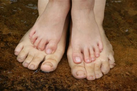 Common Foot Disorders in Children | Dallas Podiatry Works