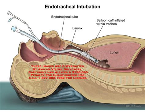 Medical Exhibits, Demonstrative Aids, Illustrations and Models