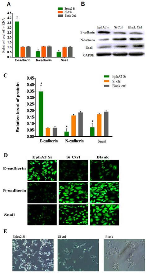 Oncotarget | EphA2 affects the sensitivity of oxaliplatin by inducing EMT in oxaliplatin ...