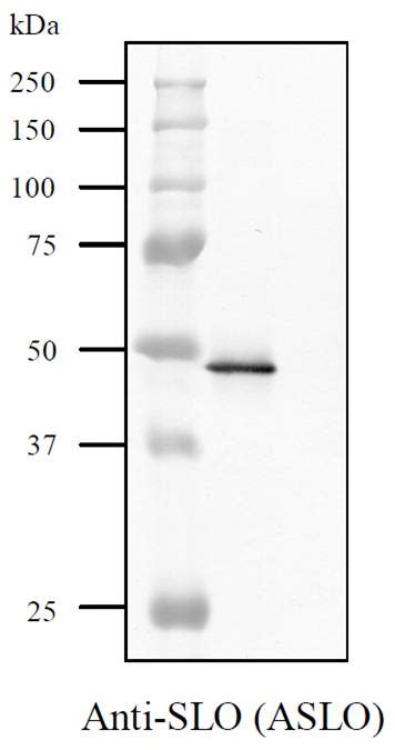 Anti-Streptolysin O antibody, rabbit polyclonal – AS ONE INTERNATIONAL