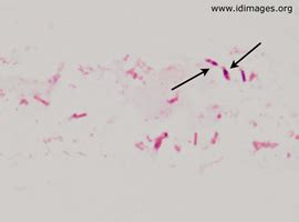 Clostridium Images - Infectious Disease Images - eMicrobes Digital Library - Atlas