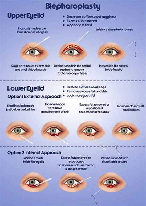 Michigan Eyelid Surgery | Ann Arbor Blepharoplasty