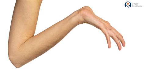 Marfan Syndrome: Symptoms, Causes & Risk Factors, Complications, Diagnosis & Treatment