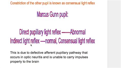 Pupillary light reflex/Marcus Gunn Pupil - YouTube