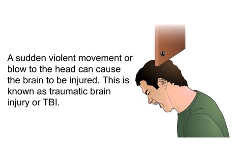 PatEdu.com : Preventing Traumatic Brain Injury