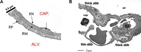 Frontiers | The impact of heterogeneity of the air-blood barrier on control of lung ...