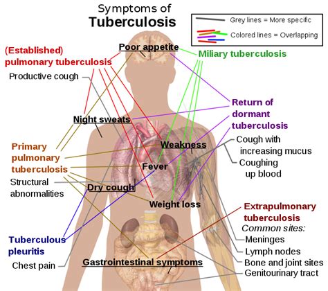 File:Tuberculosis symptoms.svg - Wikipedia, the free encyclopedia