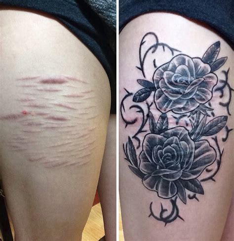 10+ Amazing Tattoos That Turn Scars Into Works Of Art | Bored Panda