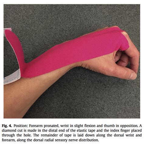 Cubital Tunnel Syndrome Kt Tape - Captions Pages