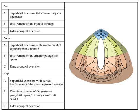 Cancers | Free Full-Text | Imaging Accuracy in Preoperative Staging of T3-T4 Laryngeal Cancers