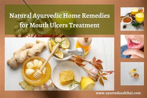 Top Ayurvedic Mouth Ulcer Remedies for Fast Relief