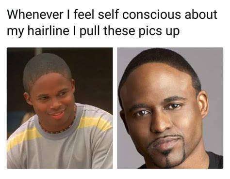 Best Hairline Jokes / 24 Jokes About Sex That Are Way Way Too Real - Hairline jokes voted the ...