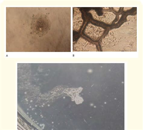 Fuligo septica. A. Spores and myxamoebae on 1.5 WA plate, B. Plasmodial ...