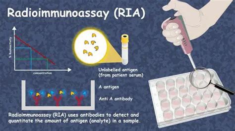 Radioimmunoassay - Applications, Principle, Procedure (Video), Vs ELISA ...