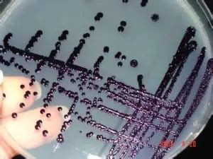 Pigment producing pathogenic bacteria & Fungus ~ University Notes