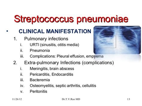 Streptococcus Pneumoniae Symptoms