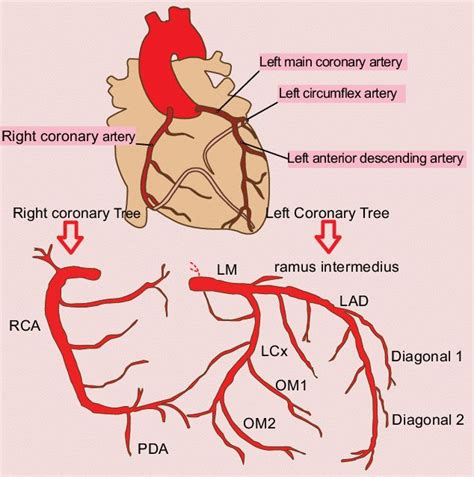 Right and left coronary trees. LAD: left anterior descending artery;... | Download Scientific ...