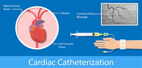 Aortic Stenosis - Keyhole & Robotic Heart Surgery in London