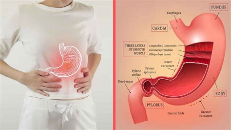 Reactive gastropathy definition, causes, symptoms, diagnosis & treatment