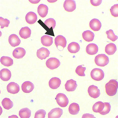 Keratocytes | Test Findings - MedSchool