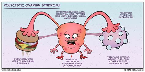 Polycystic Ovarian Syndrome | Polycystic ovarian syndrome, Nursing notes, Medical