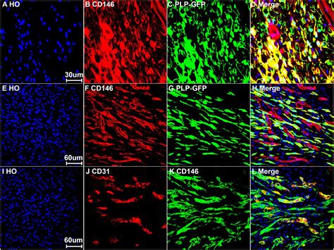 Frontiers | Up-Regulation of CD146 in Schwann Cells Following Peripheral Nerve Injury Modulates ...